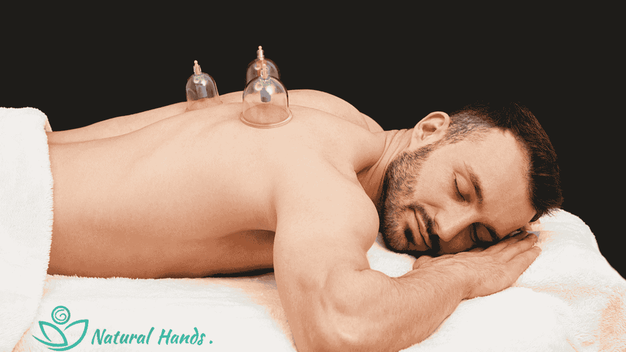 A therapist applying silicone or glass cups to a client’s back for myofascial cupping therapy.